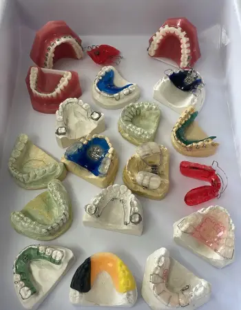 Herausnehmbare/festsitzende Zahnspangen